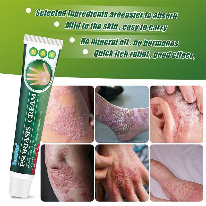 Sumifun Psoriasis Cream introduced-2